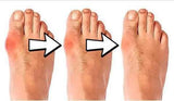 FEETPAD CORRECTEUR (LIVRAISON GRATUITE)